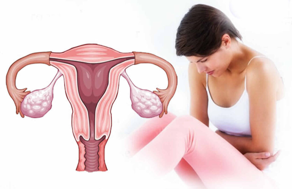 Abnormal Uterine Bleeding: Dr. Vartika Srivastava