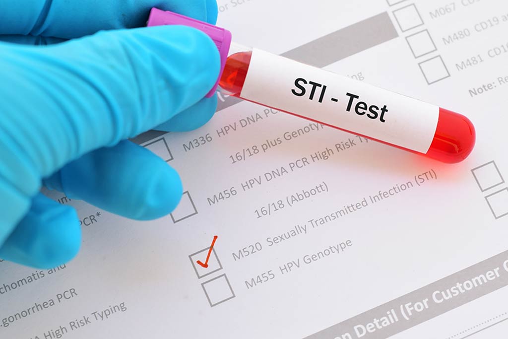 STIs & STDs Test and Treatment in Prayagraj