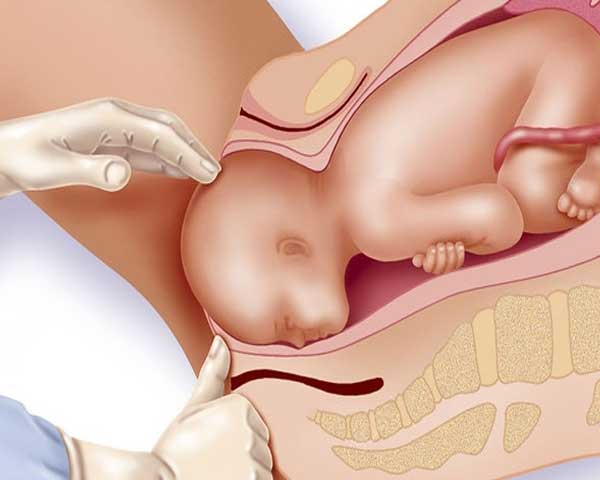 Normal Vaginal Delivery